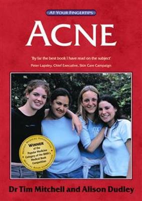 Acne: Answers at Your Fingertips